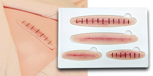Clinical Assessment Kit Surgical Wound